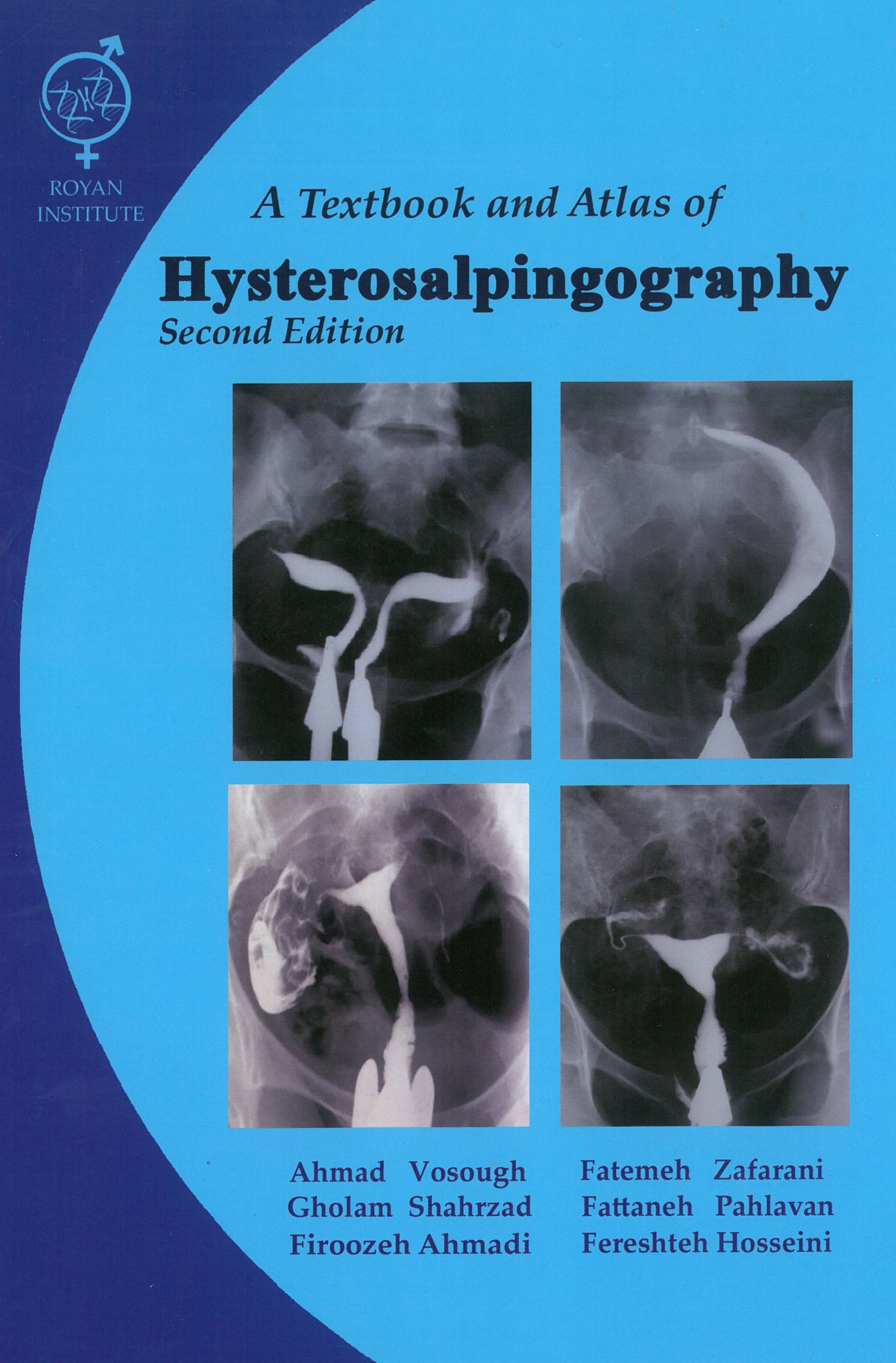 A Textbook and Atlas of Hysterosalpingography Second Edition (هیستروسالپنگوگرافی) 